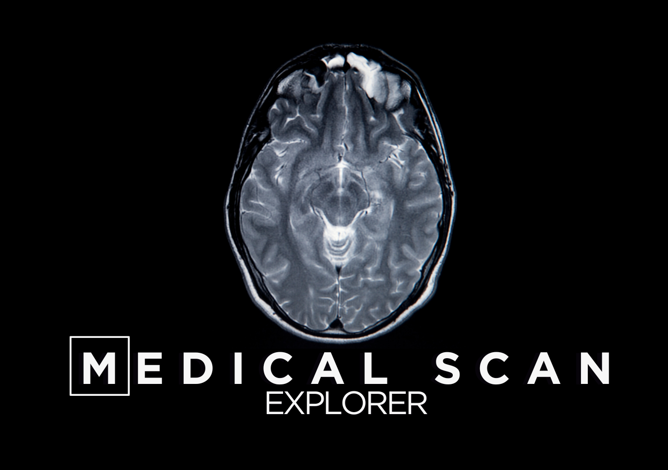 Medical Scan Explorer Tilt Five